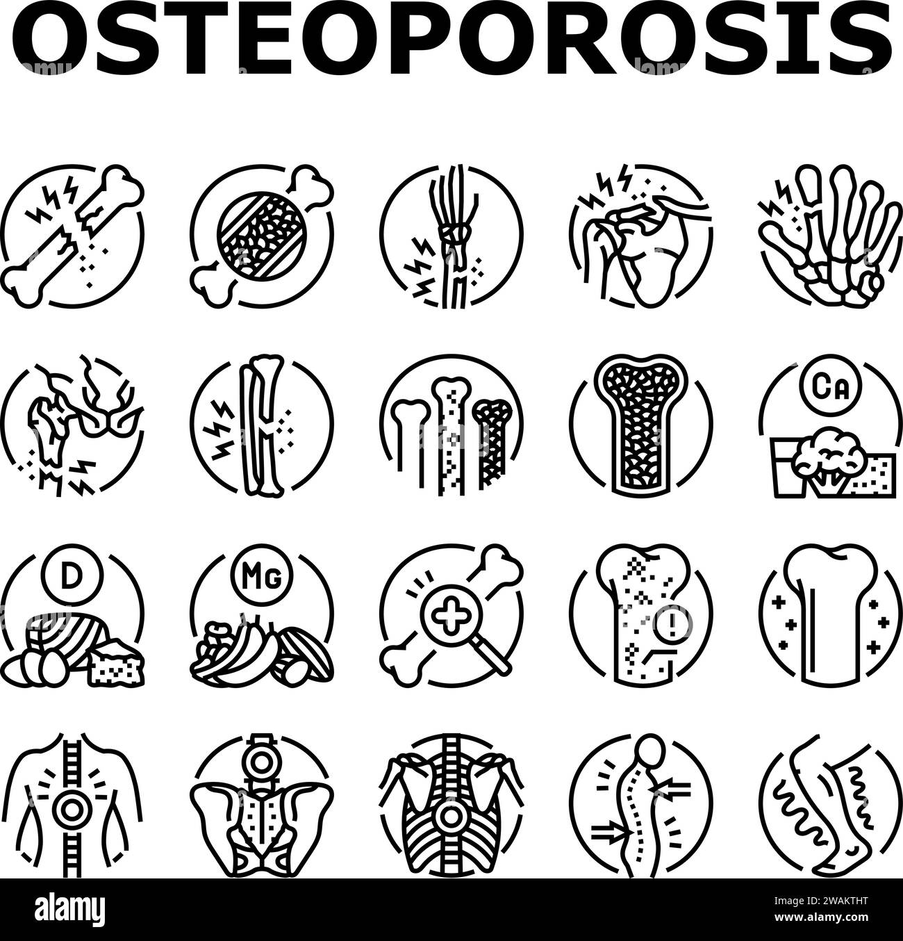 is gabapentin used for osteoporosis