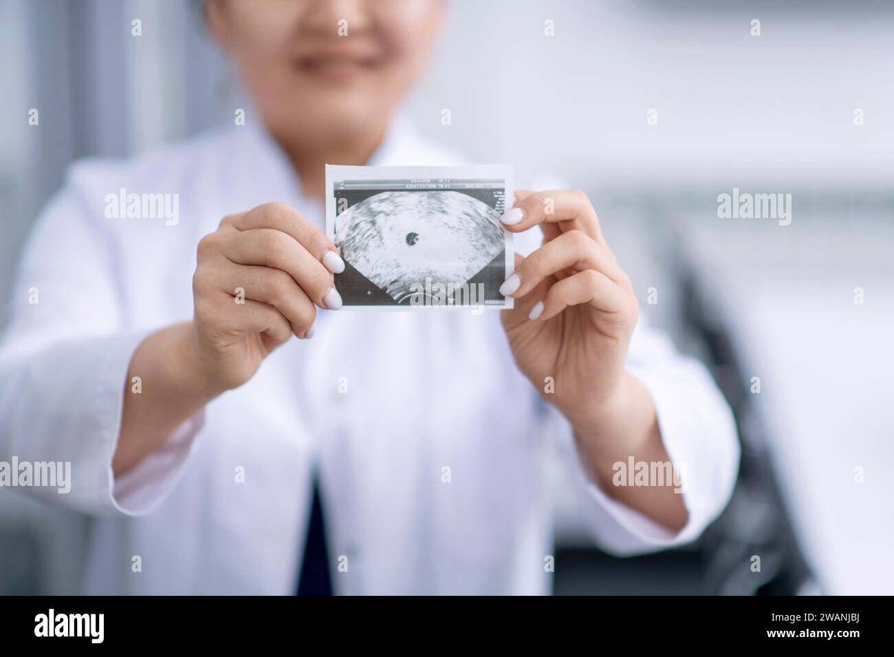 The doctor holds in his hands the result of an ultrasound scan of a pregnant woman. Stock Photo