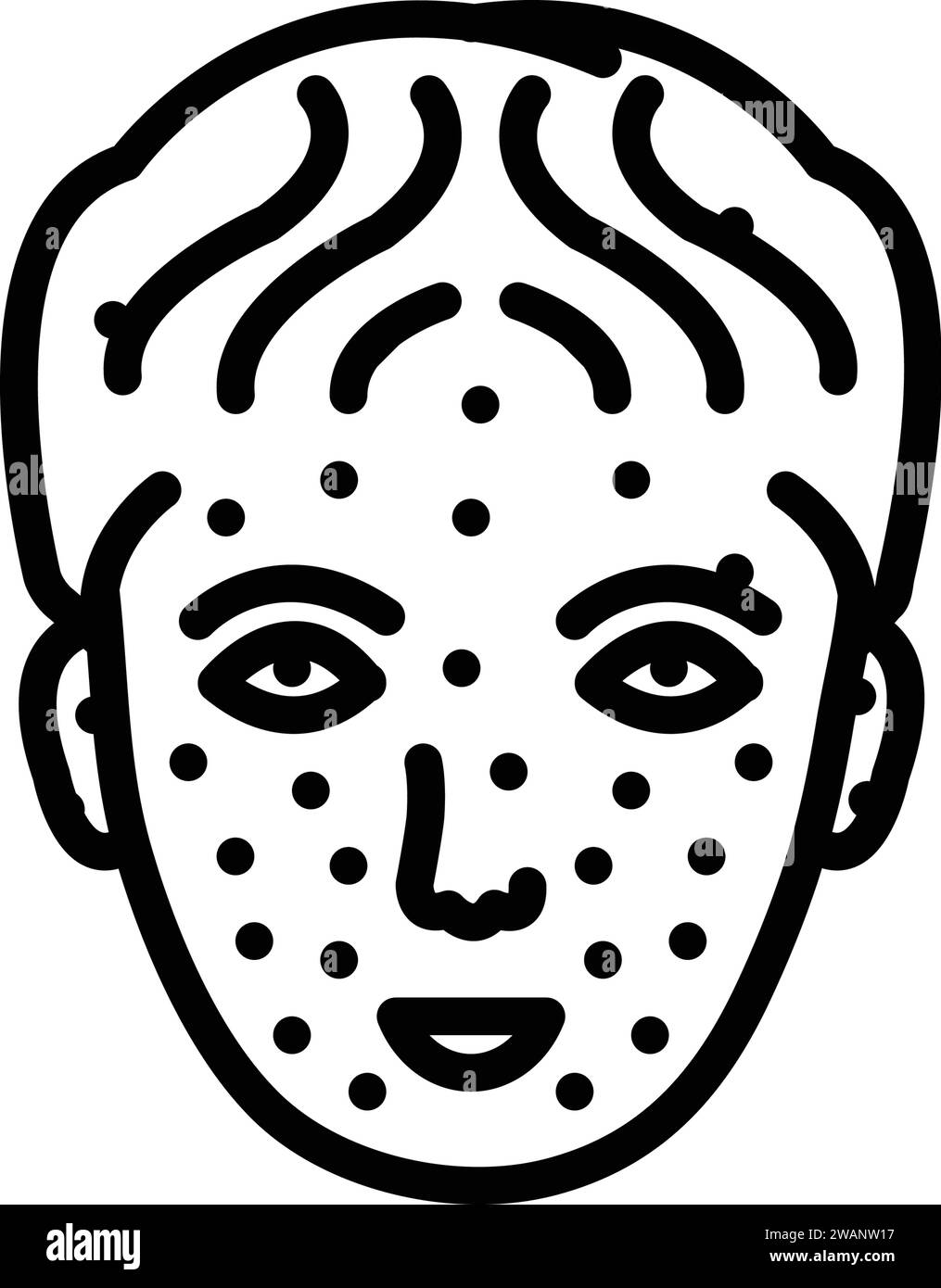 Chickenpox illustration Cut Out Stock Images & Pictures - Alamy