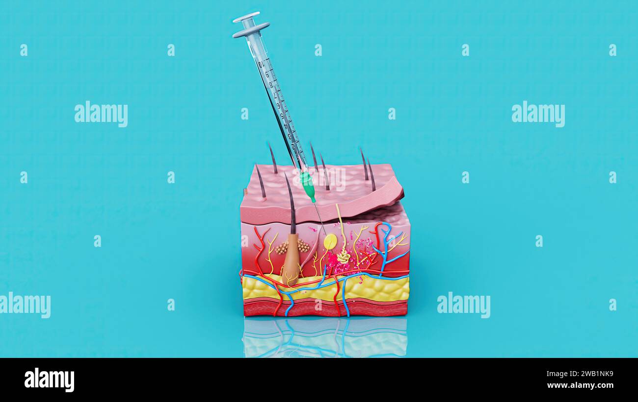 Abstract illustration of a subcutaneous injection Stock Photo Alamy