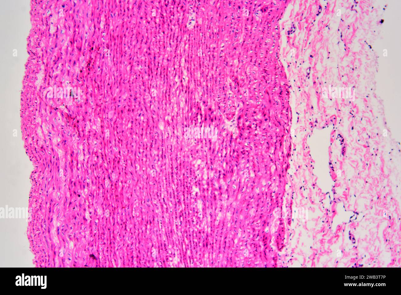 Human artery cross section showing tunica externa, tunica media with
