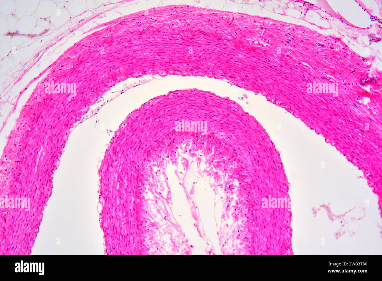 Human artery cross section showing tunica externa, tunica media with smooth muscle fibers and