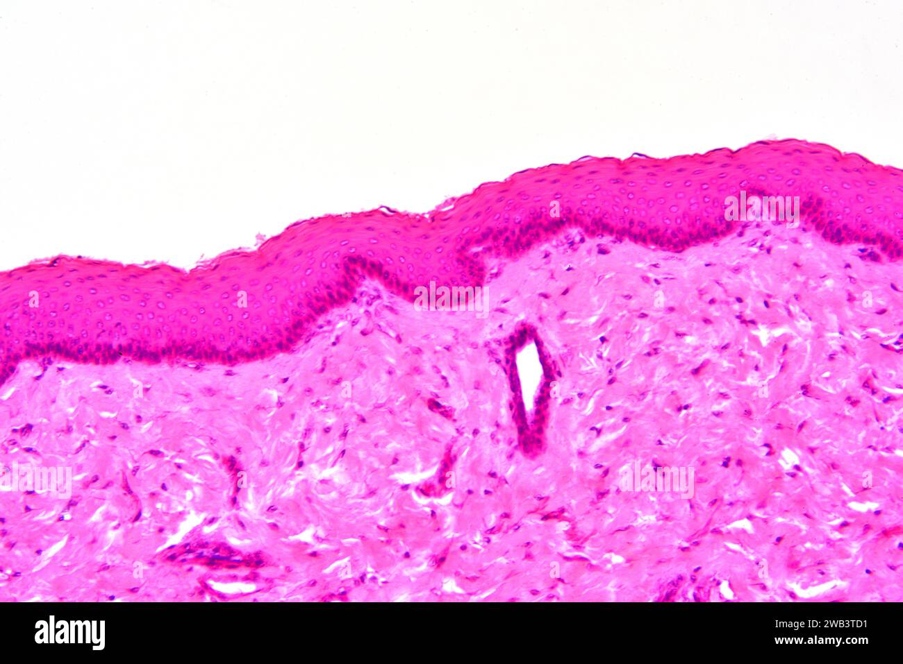 Human transitional epithelium and smooth muscle tissue. X125 at 10 cm wide. Stock Photo