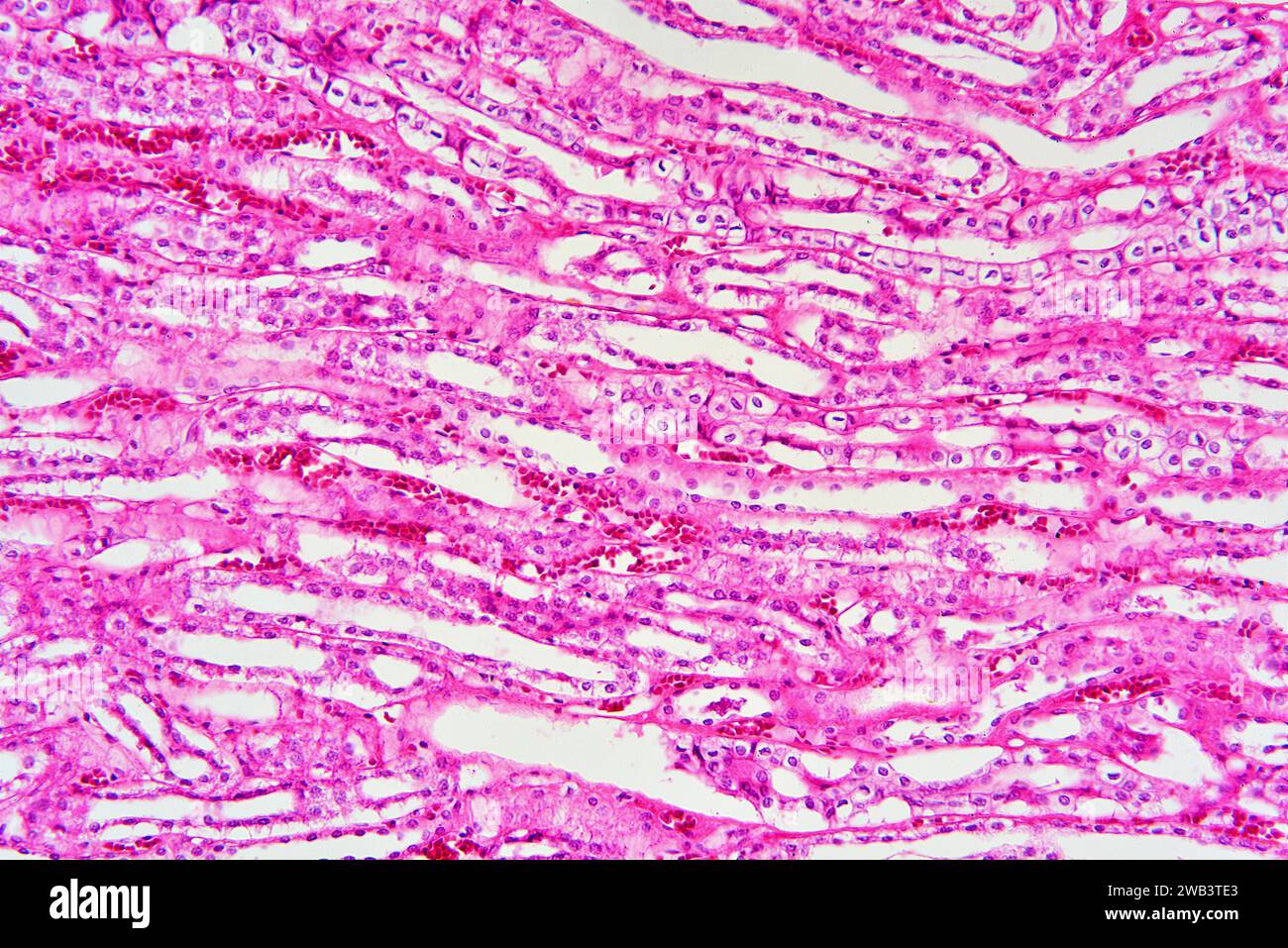 Human cuboidal epithelium of kidney. X75 at 10 cm wide. Stock Photo