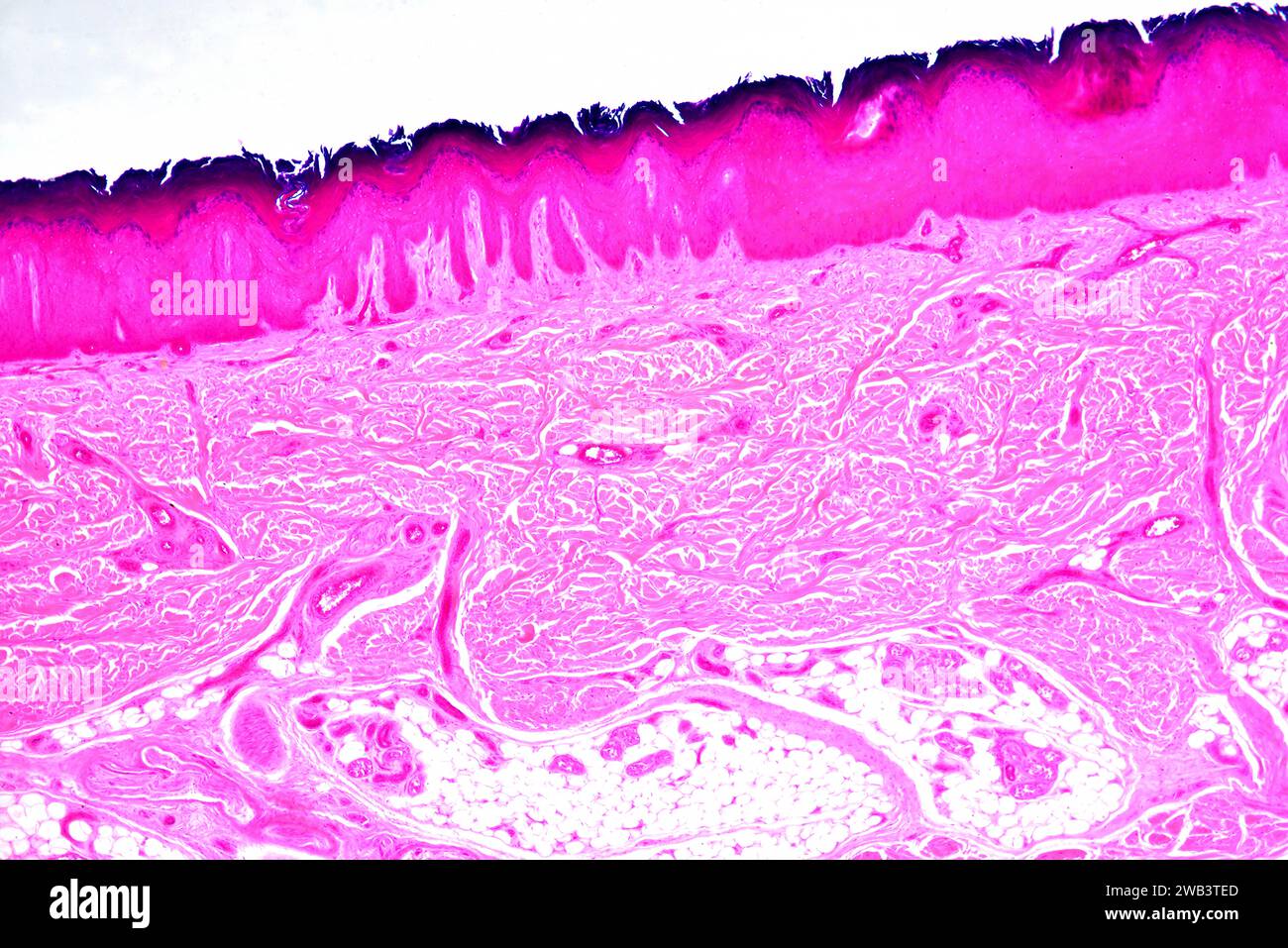 Stratified squamous epithelium from human hand skin showing keratinized epidermis and dermis with connective tissues. X25 at 10 cm wide. Stock Photo