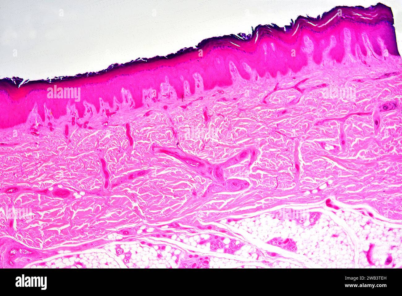 Stratified squamous epithelium from human hand skin showing keratinized epidermis and dermis with connective tissues. X25 at 10 cm wide. Stock Photo