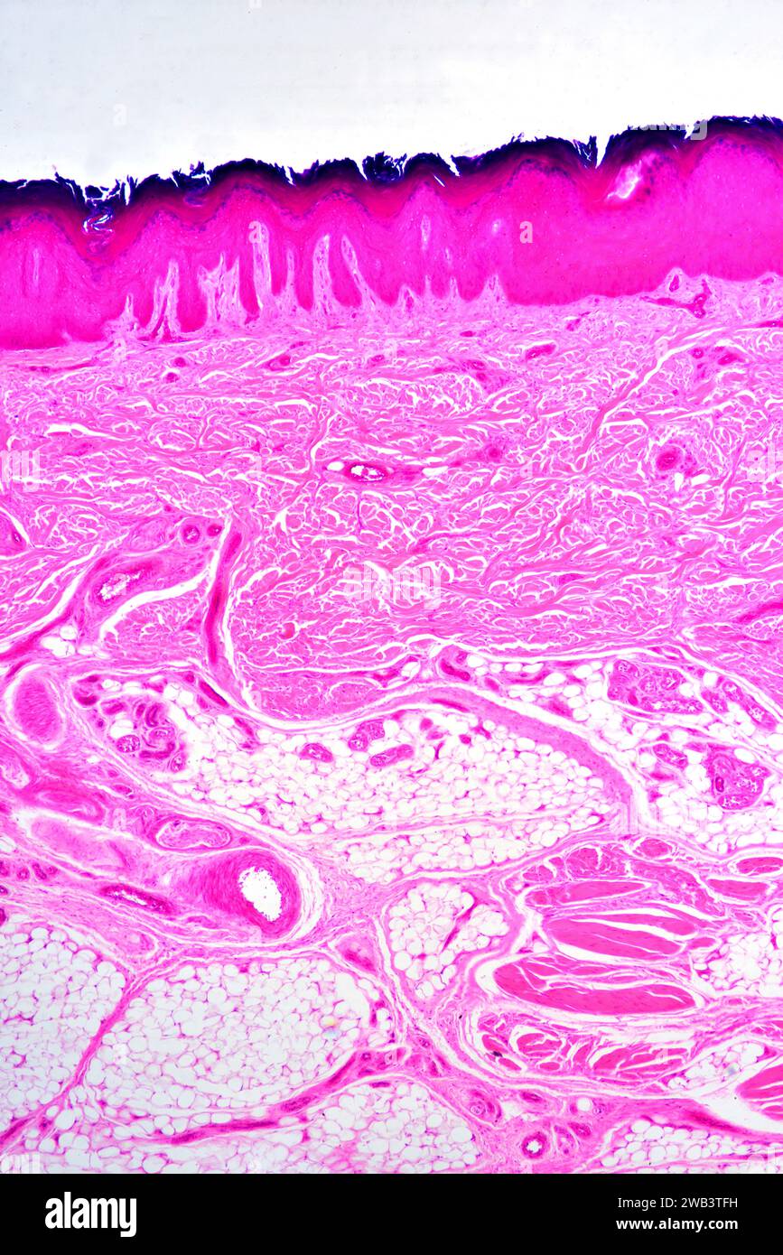 Stratified squamous epithelium from human hand skin showing keratinized epidermis and dermis with connective tissues. X25 at 10 cm wide. Stock Photo