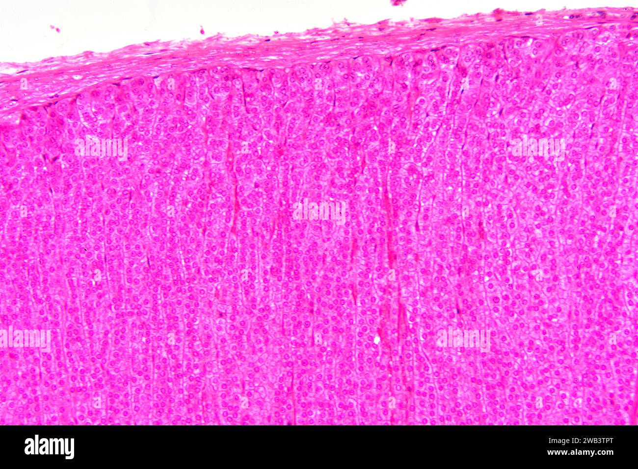 Human adrenal gland section showing from top to bottom: fibrous capsule, zona glomerulosa and zona fasciculata. Human adrenal gland or suprarenal glan Stock Photo