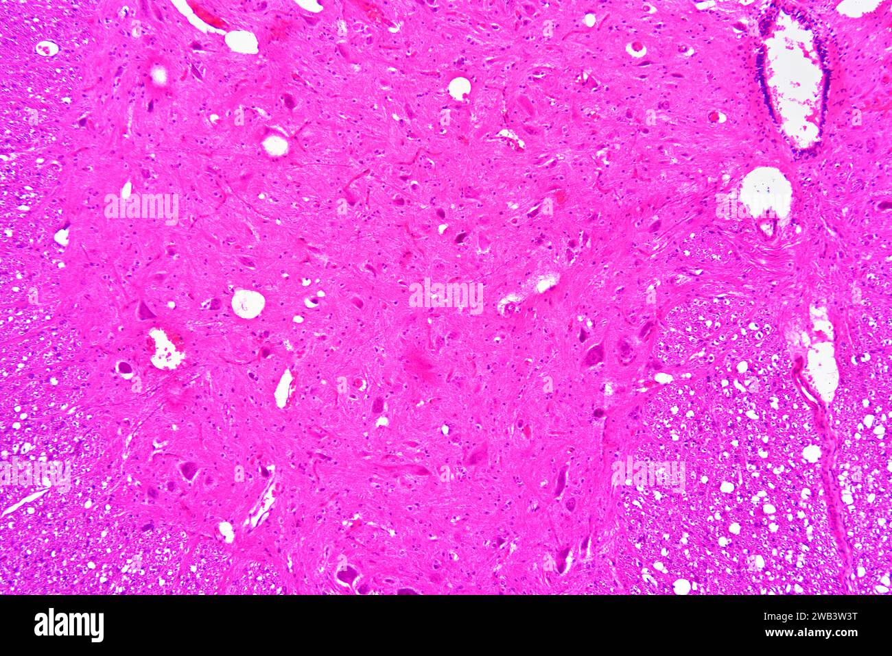 Human spinal cord hi-res stock photography and images - Alamy