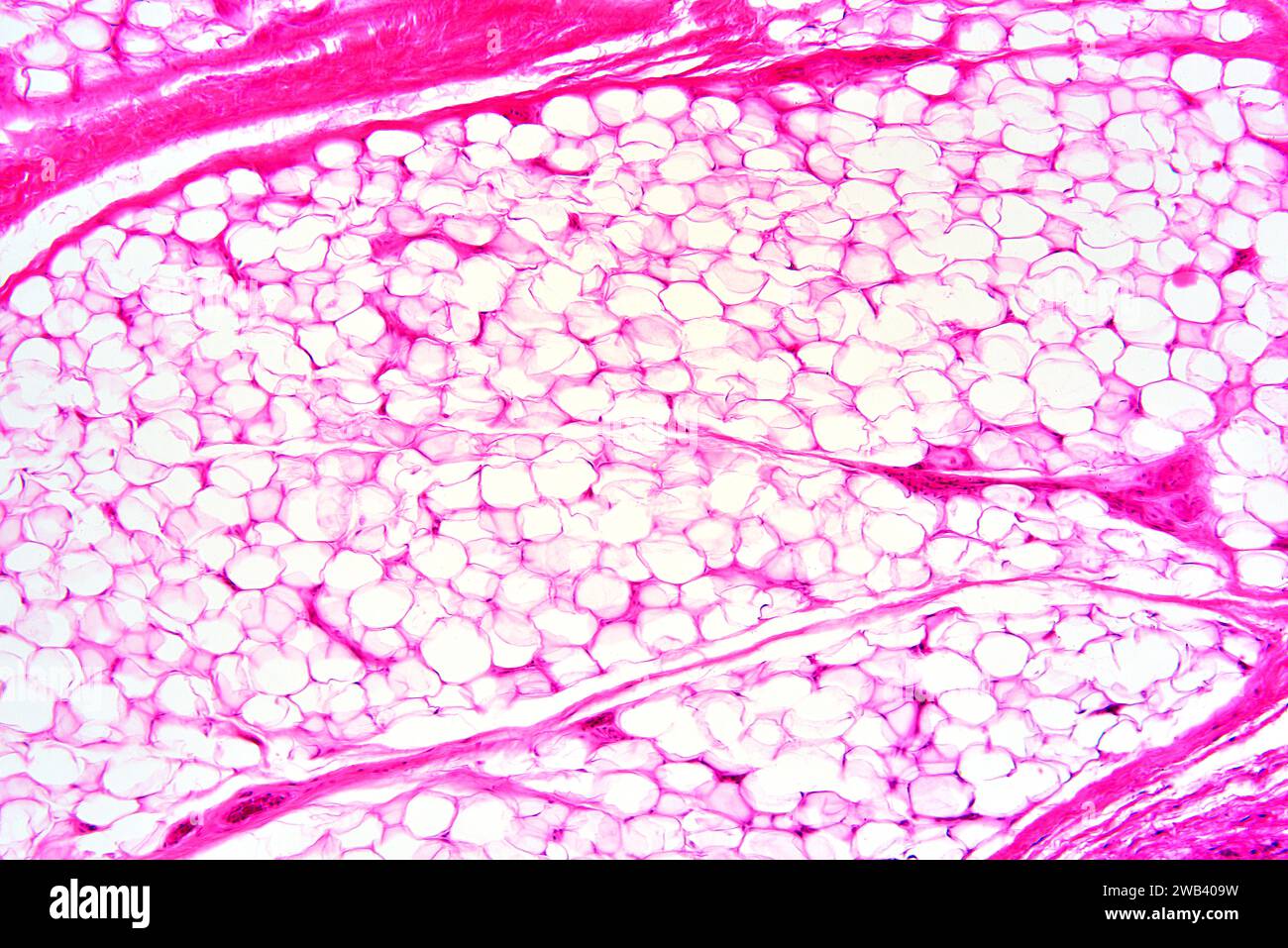 Adipose tissue micrograph hires stock photography and images Alamy