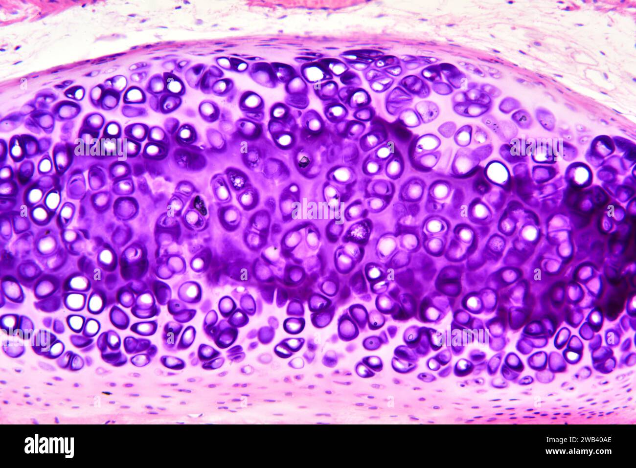 Hyaline cartilage microscope hires stock photography and images Alamy