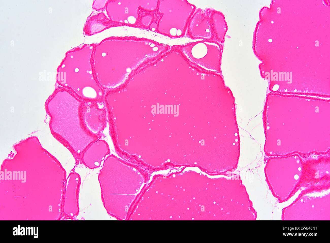 Human thyroid gland section showing colloid and follicular cells. X75