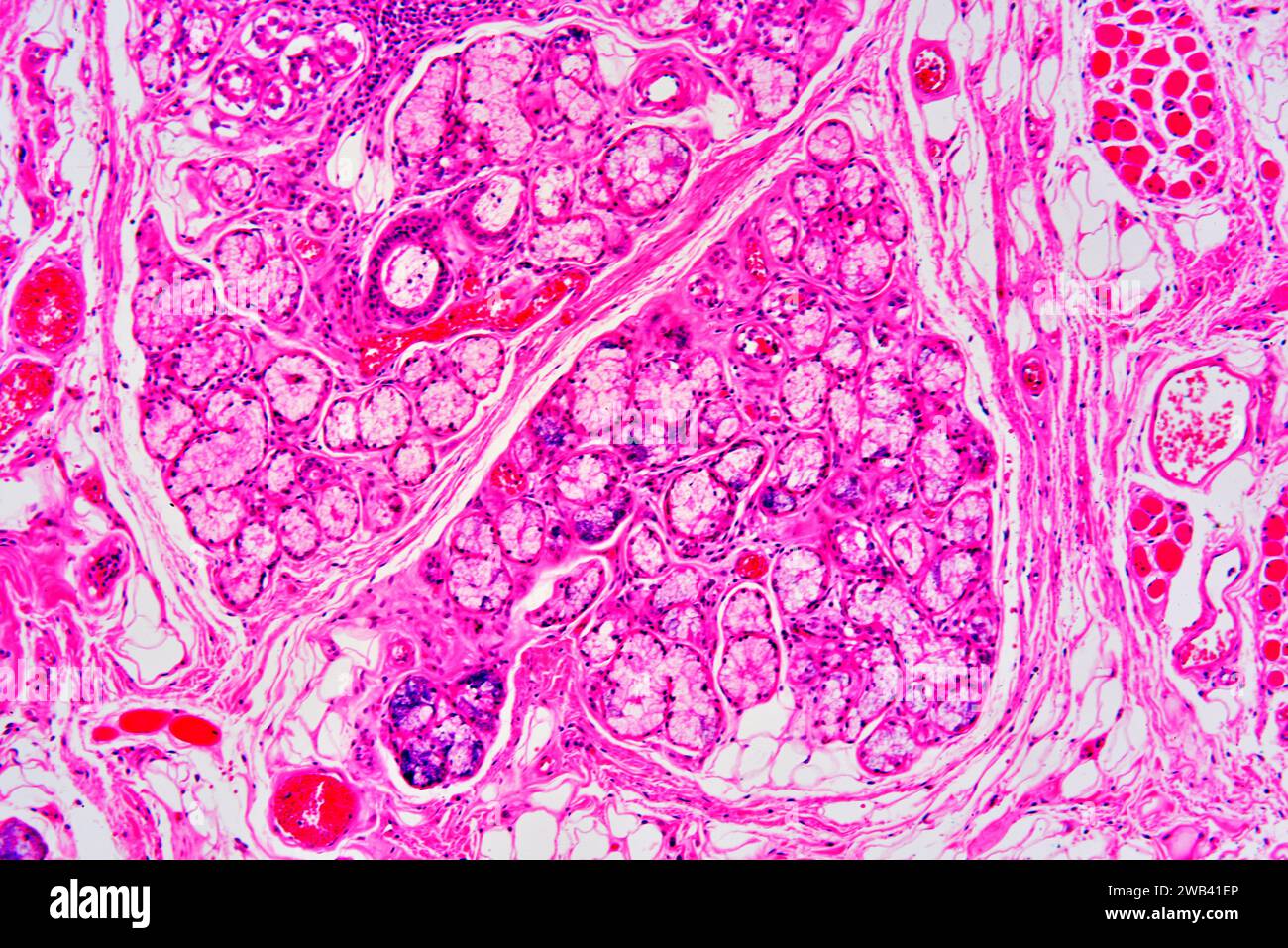 Parotid gland is the bigger salivary gland. We can see mucous gland (Weber gland), serous gland (Ebner gland), connective tissue, muscle fibers and bl Stock Photo