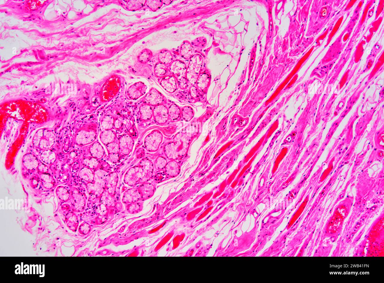 Parotid gland is the bigger salivary gland. We can see mucous gland (Weber gland), connective tissue, muscle fibers and blood vessels. Photomicrograph Stock Photo