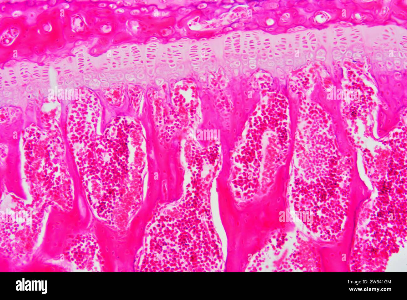Red marrow (bone marrow), an hematopietic organ. Photomicrograph X150 at 10 cm wide. Stock Photo