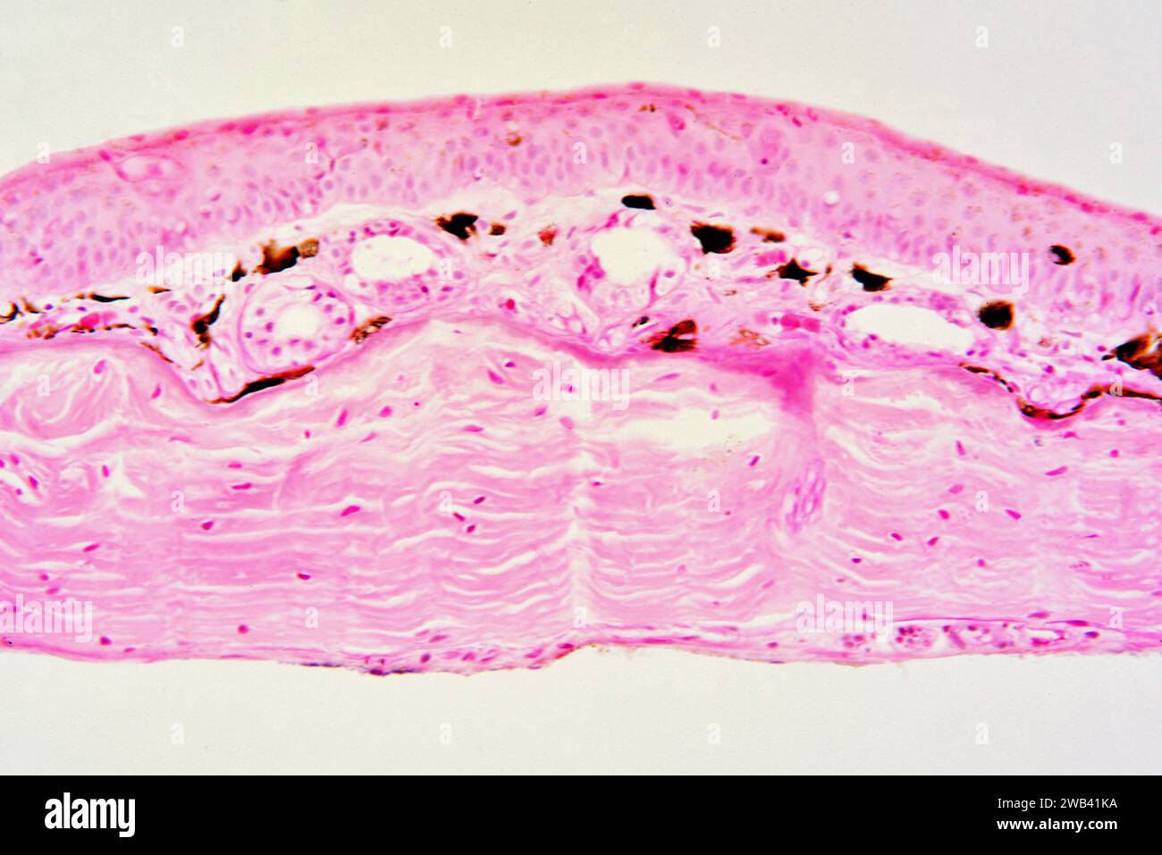 Frog skin showing epidermis, pigmentary layer with melanocytes (brown), blood vessels and dermis. Photomicrograph X150 at 10 cm wide. Stock Photo