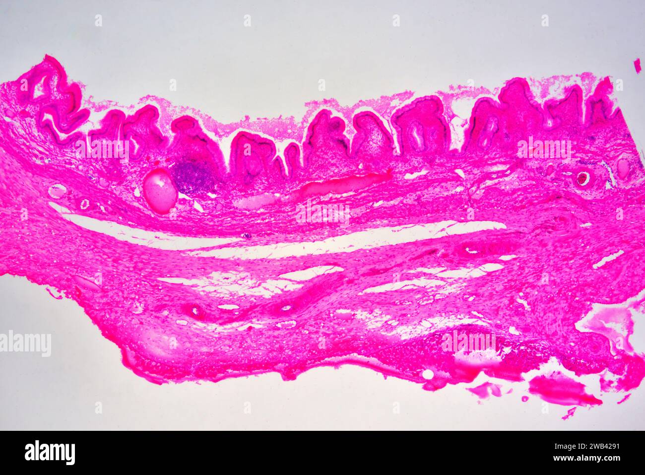 Gallbladder wall showing columnar epithelium with mucosal folds, connective tissue and smooth muscle fibers. Photomicrograph X30 at 10cm wide. Stock Photo