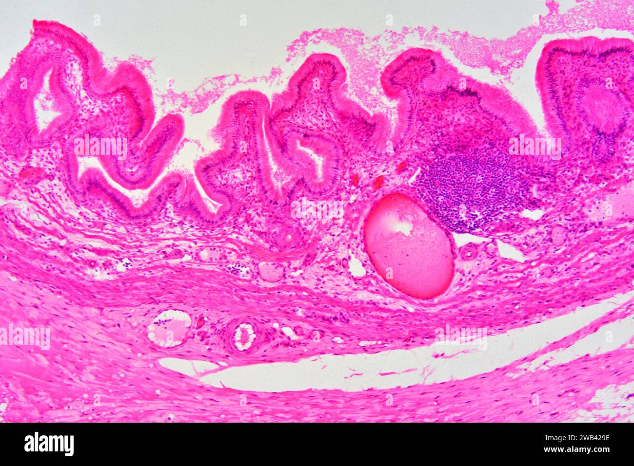Gallbladder wall showing columnar epithelium with mucosal folds, connective tissue, blood vessels and smooth muscle fibers. Photomicrograph X75 at 10 Stock Photo