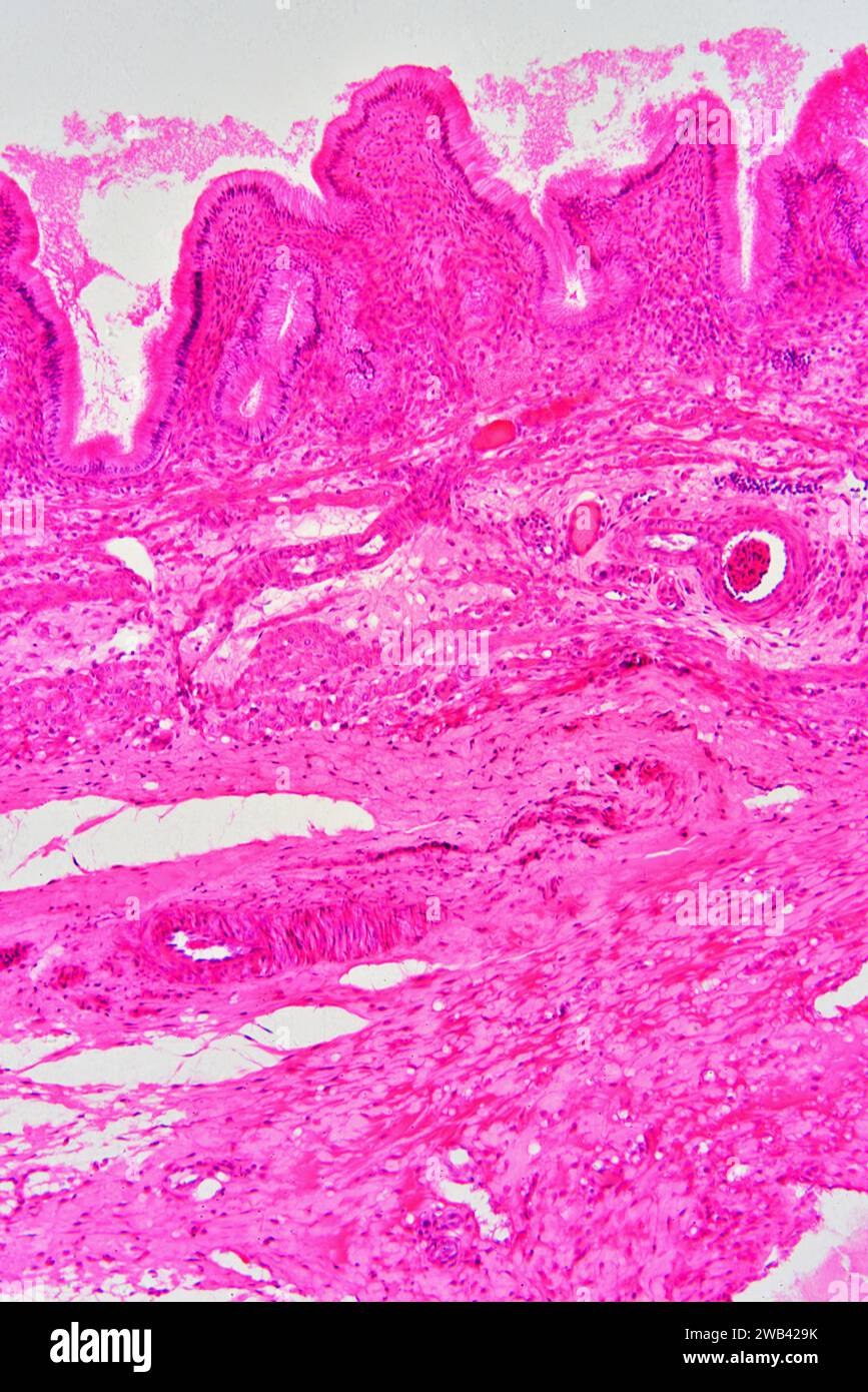 Gallbladder wall showing columnar epithelium with mucosal folds, connective tissue, blood vessels and smooth muscle fibers. Photomicrograph X75 at 10 Stock Photo