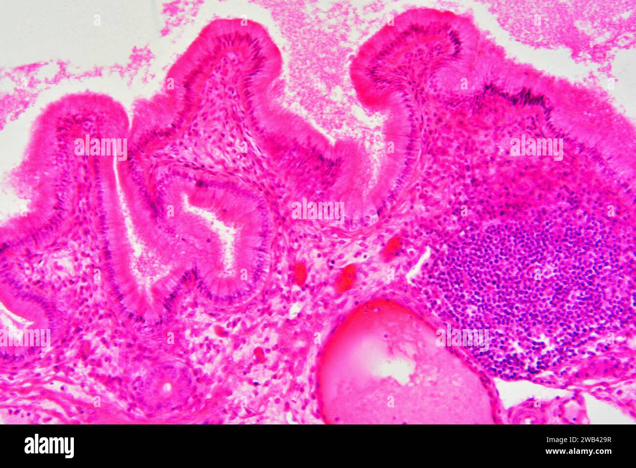 Gallbladder wall showing columnar epithelium with mucosal folds, connective tissue, blood vessels and smooth muscle fibers. Photomicrograph X150 at 10 Stock Photo