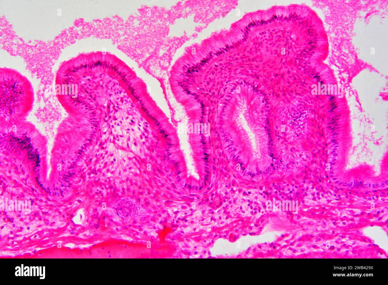 Gallbladder wall showing columnar epithelium with mucosal folds, connective tissue and smooth muscle fibers. Photomicrograph X150 at 10cm wide. Stock Photo