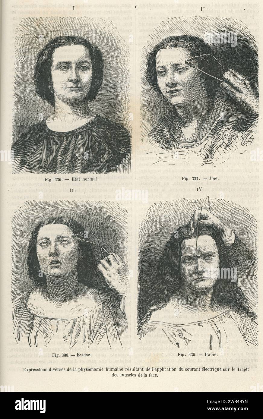 Various facial expressions obtained using the apparatus of the French physician Guillaume Duchenne de Boulogne (nicknamed Duchenne de Boulogne), which uses alternating current to stimulate muscle bundles with precision.  c.1830  Illustration from 'Les Merveilles de la science ou description populaire des inventions modernes' written by Louis Figuier and published in 1867 by Furne, Jouvet et Cie. Stock Photo
