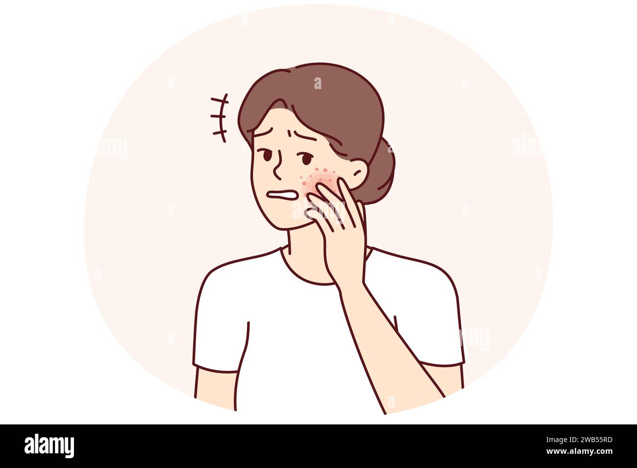 Unhappy woman gets frightened after seeing redness on face suffering