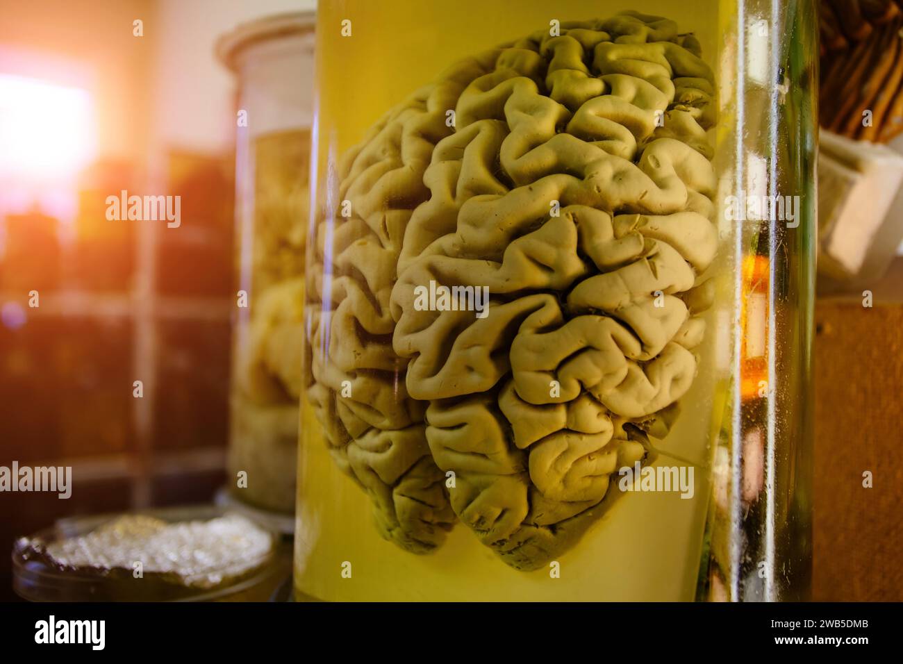 Human brain in glass jar with formaldehyde for medical studies. Stock Photo