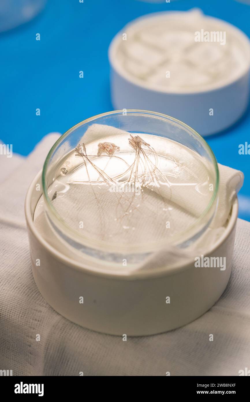 A closeup of long hair follicular units in a surgical vessel for long hair transplant. Stock Photo