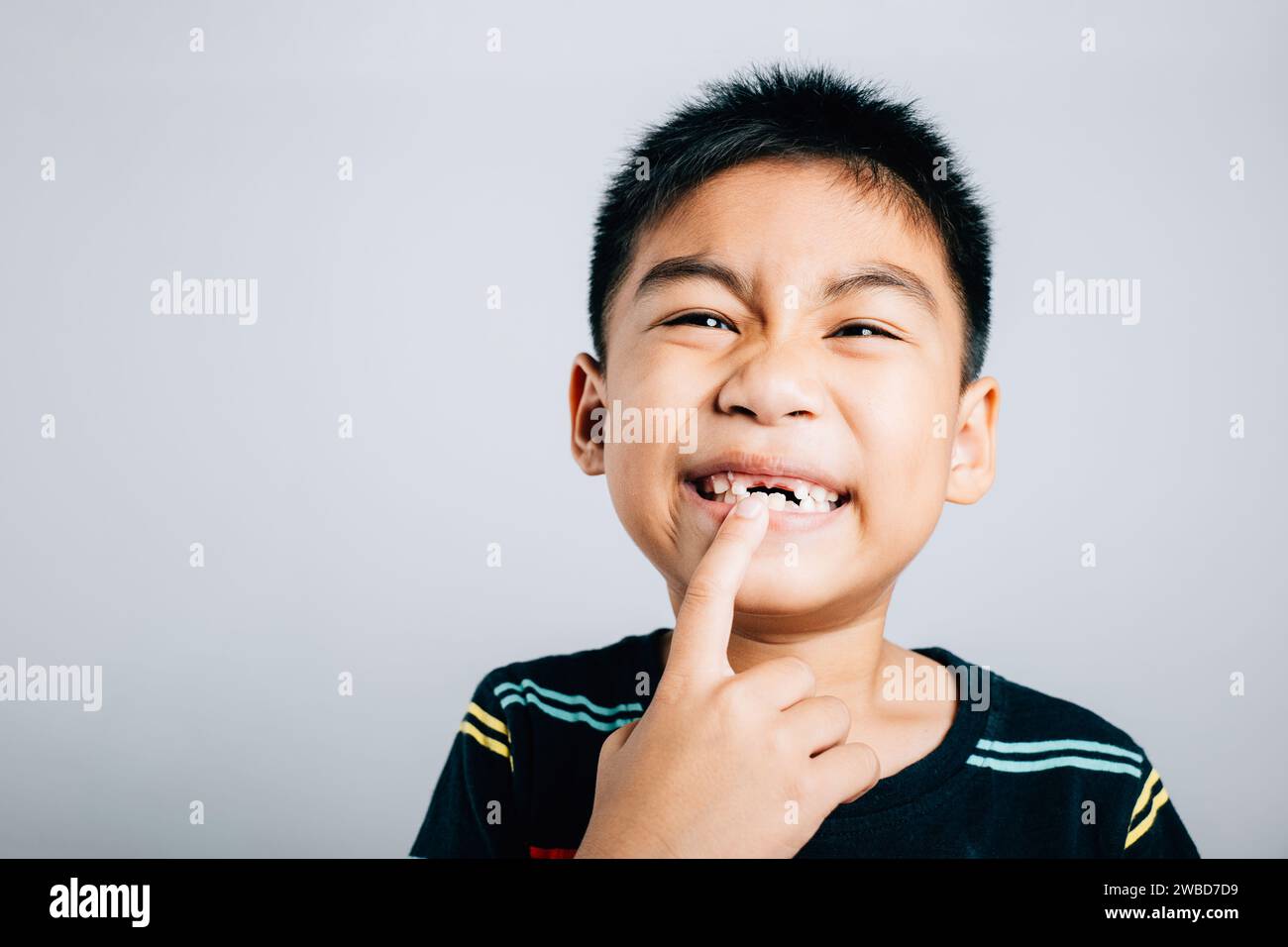 Little boy wide smile reveals gap of growing molar. At six years old