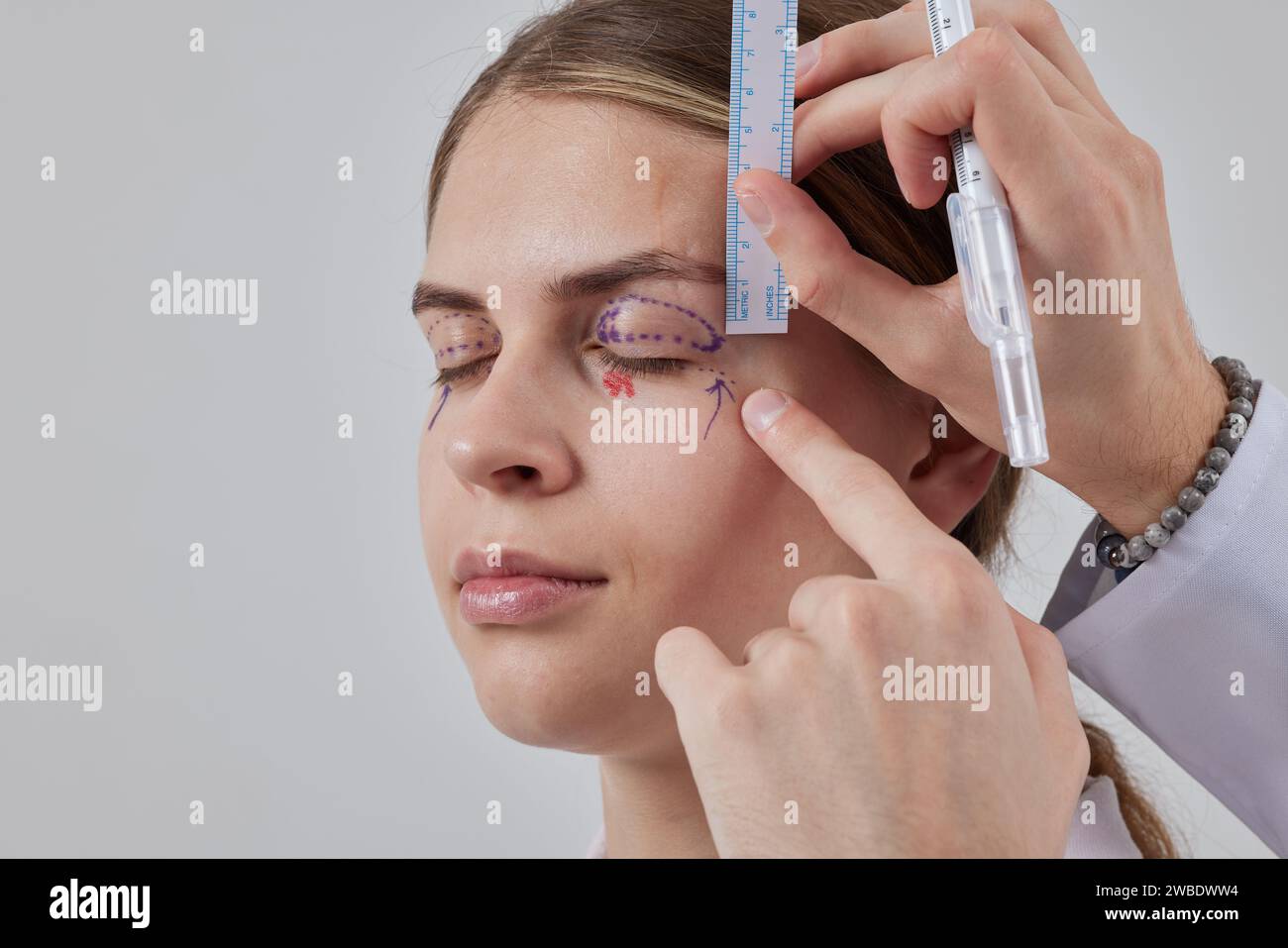 plastic surgeon prepares for Blepharoplasty, Blepharoplasty operation