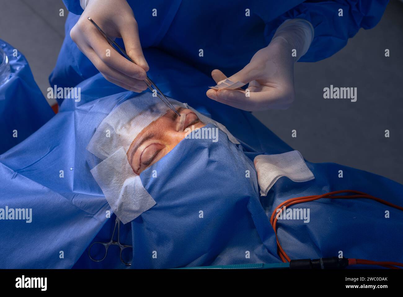 closeup eyes after eye surgery , blepharoplasty operation, plastic