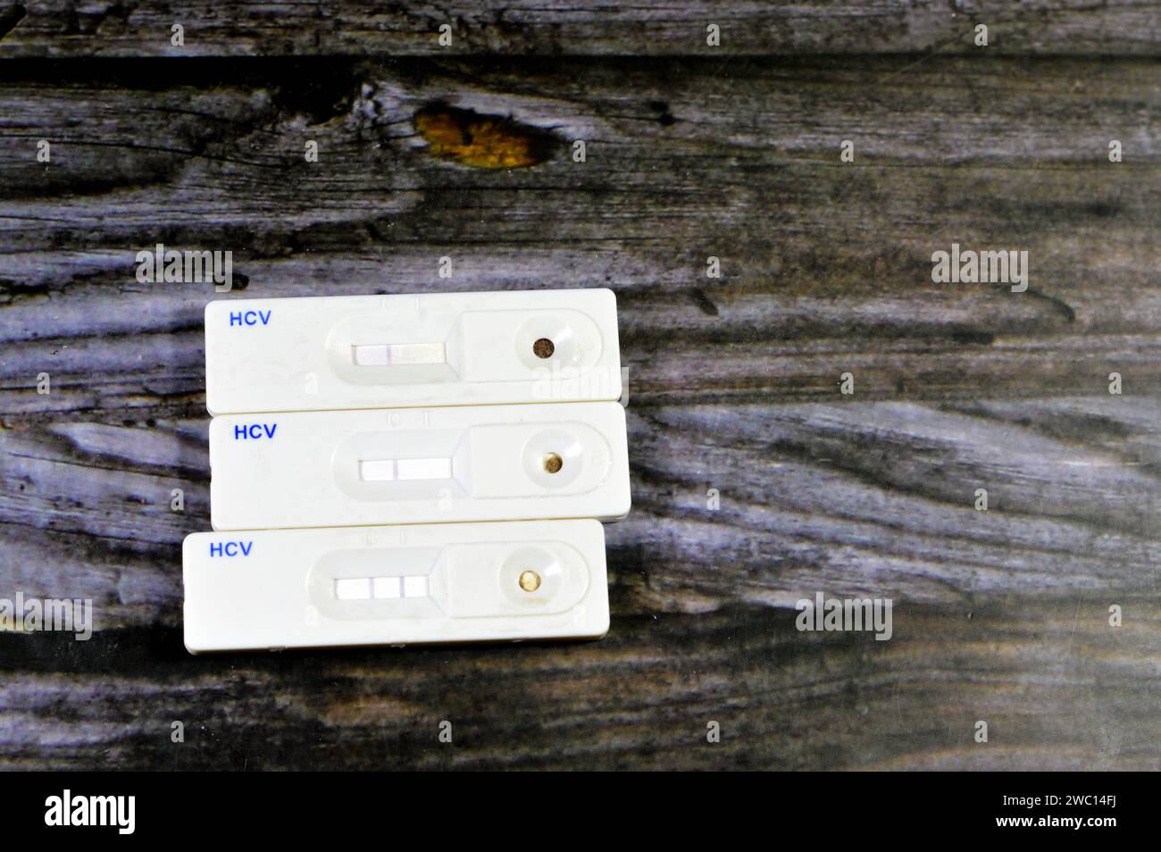 Positive and negative results of HCV blood sample rapid screening test