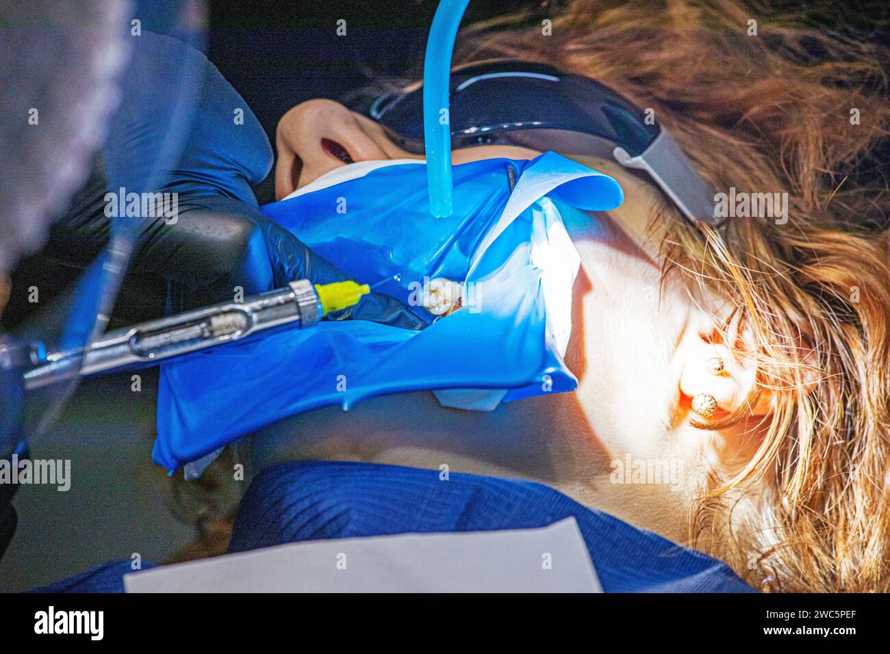 dentist administers anesthesia before treating a patient's aching tooth