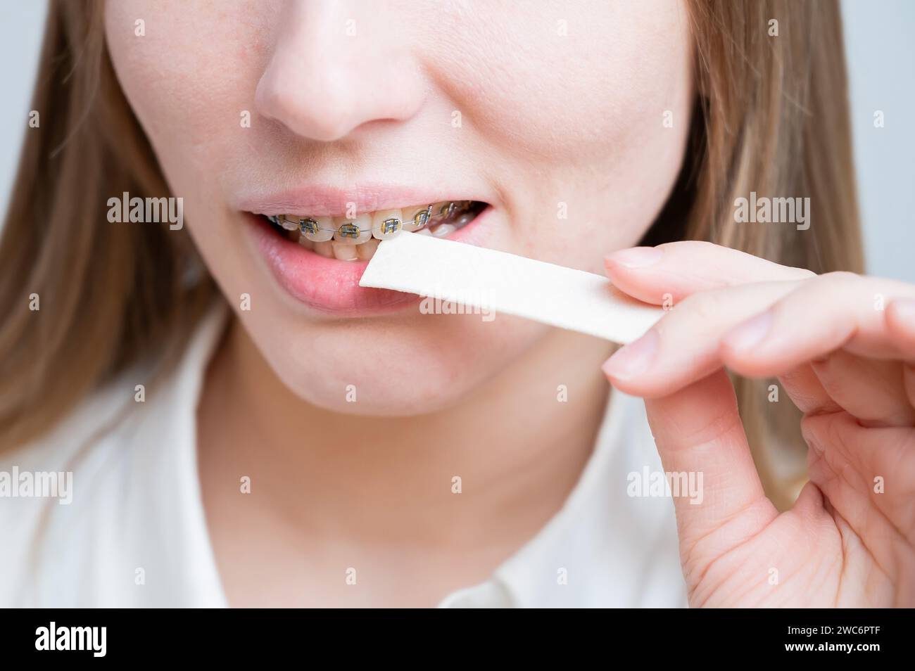 Young woman with metal braces on her teeth is chewing gum Stock Photo Alamy