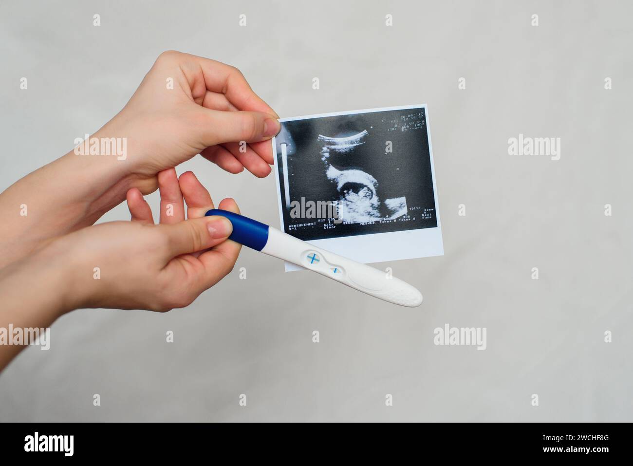ultrasound picture and positive pregnancy test in the hands of a girl closeup Stock Photo Alamy