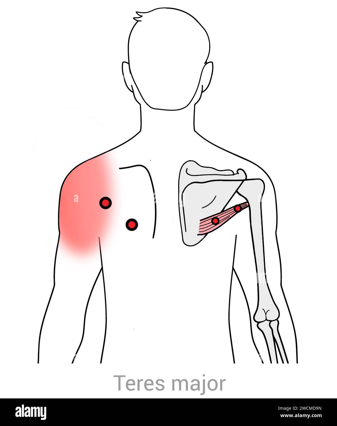Tricep pain cut out stock images pictures alamy