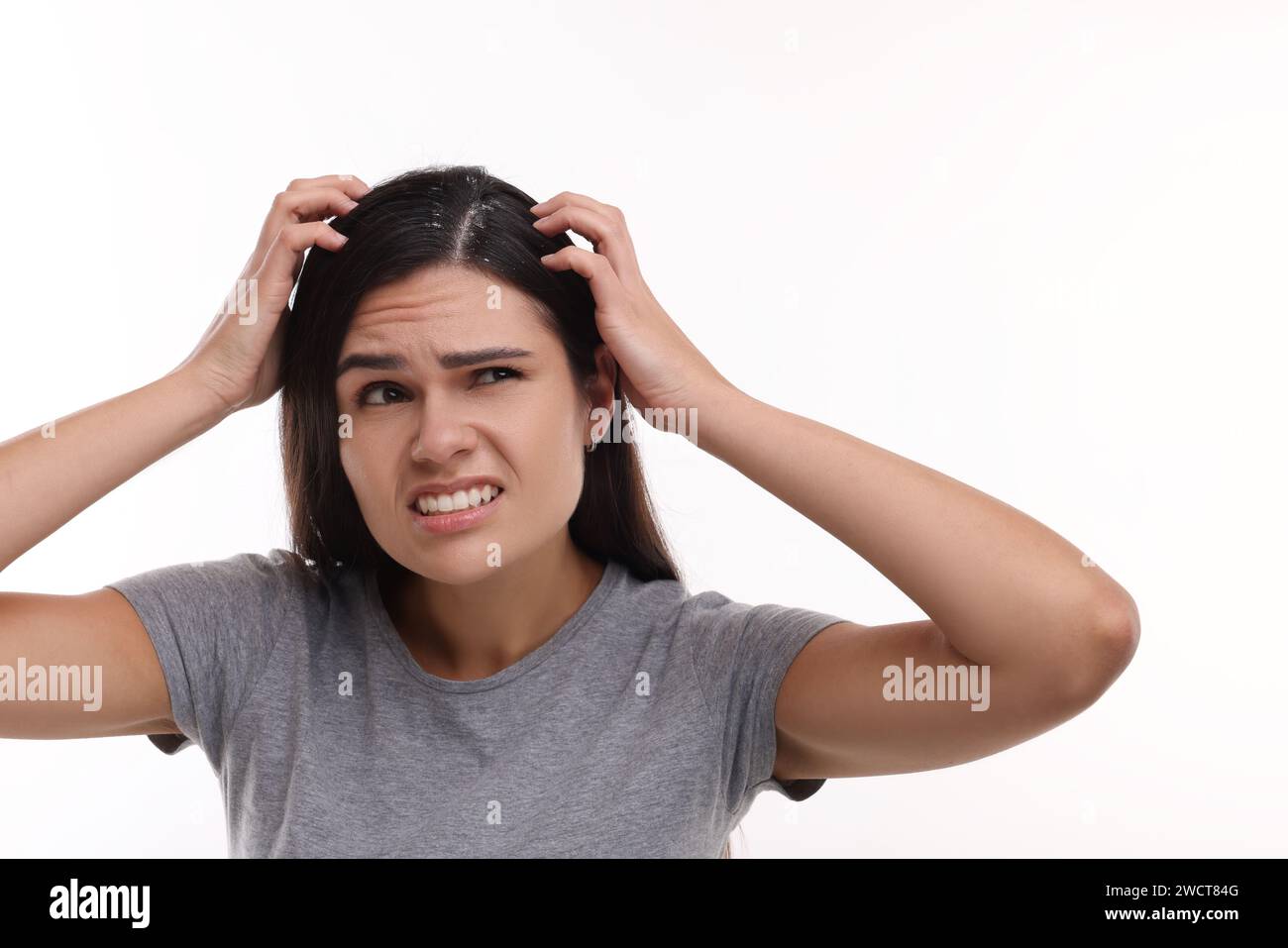 Emotional Woman Examining Her Hair And Scalp On White Background