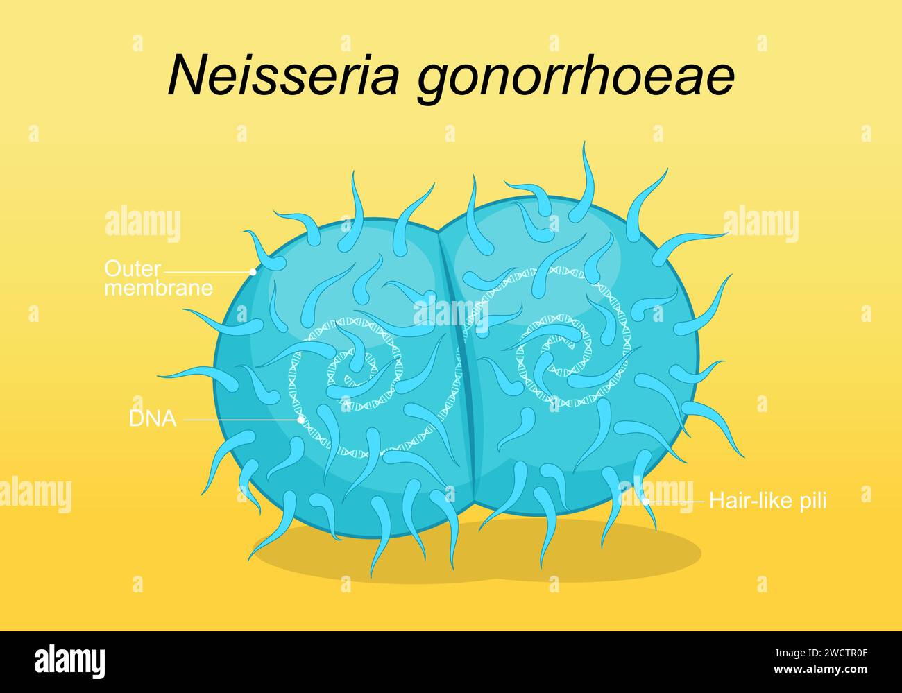 Neisseria gonorrhoeae pathogen bacteria. Sexually transmitted disease and gonococcus infection. Genital tract infection. Vector poster Stock Vector