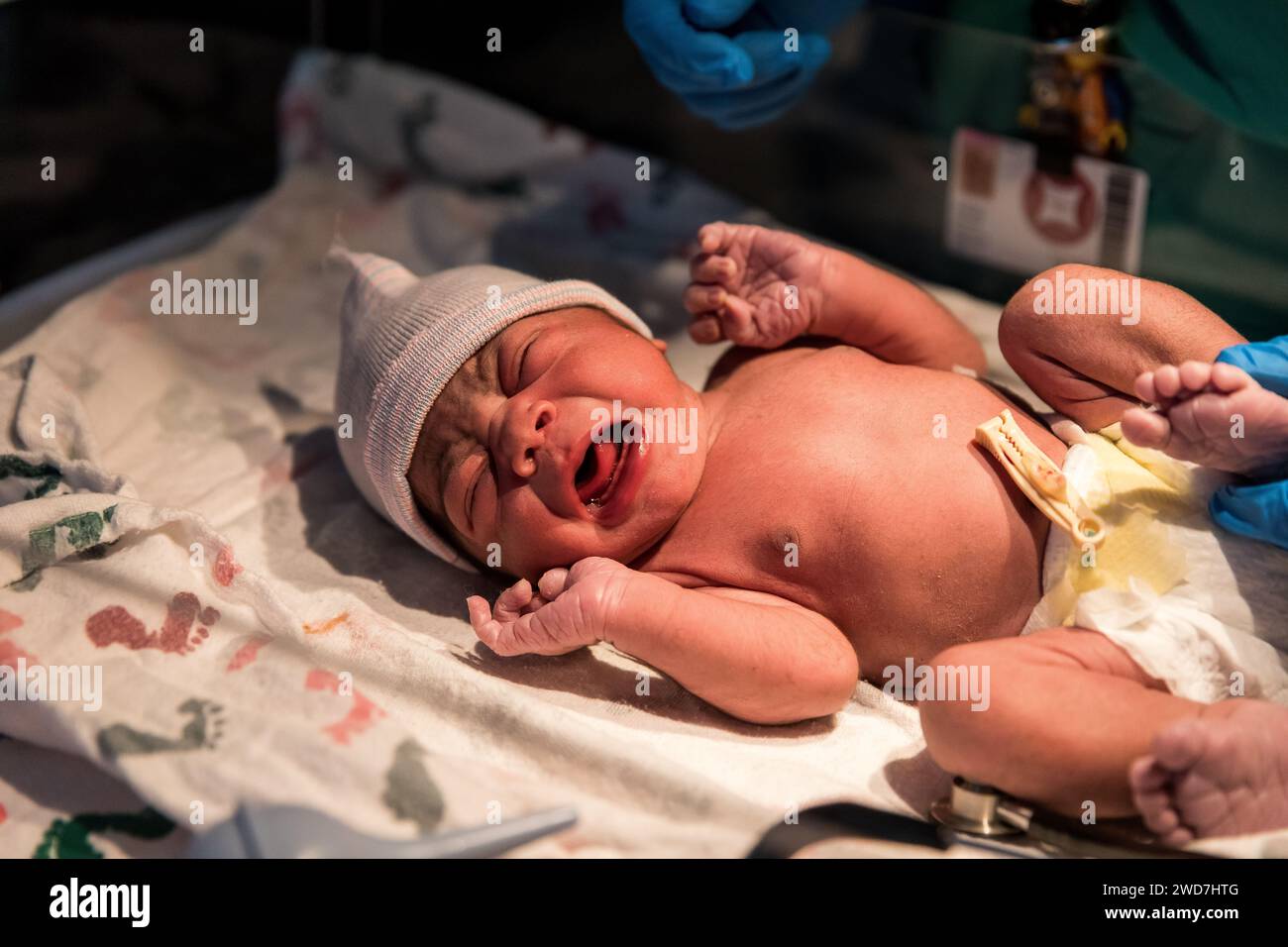 Multiracial baby cries while being weighed at nurse's station Stock Photo