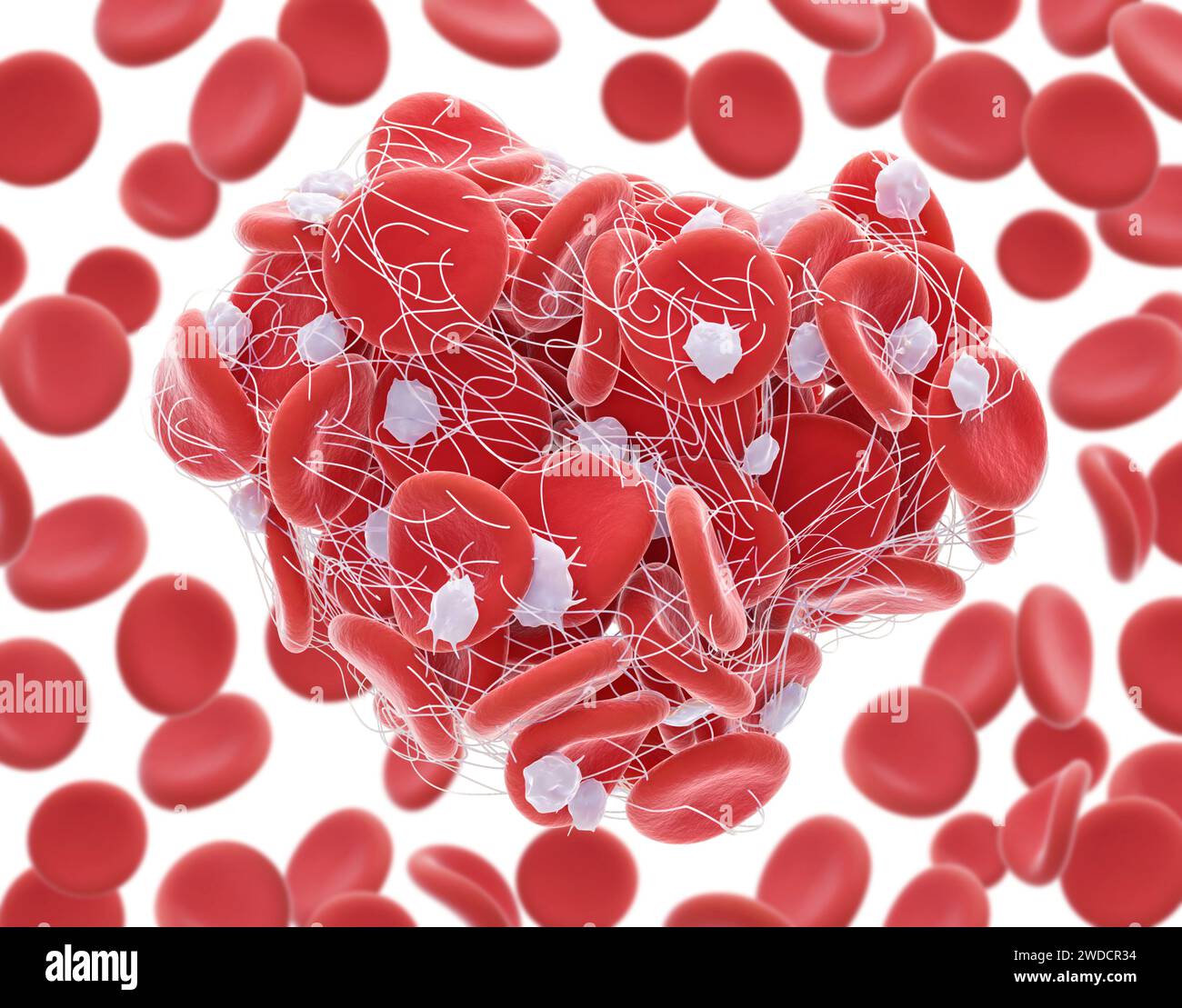 Illustration of red blood cells (erythrocytes) trapped in a fibrin mesh