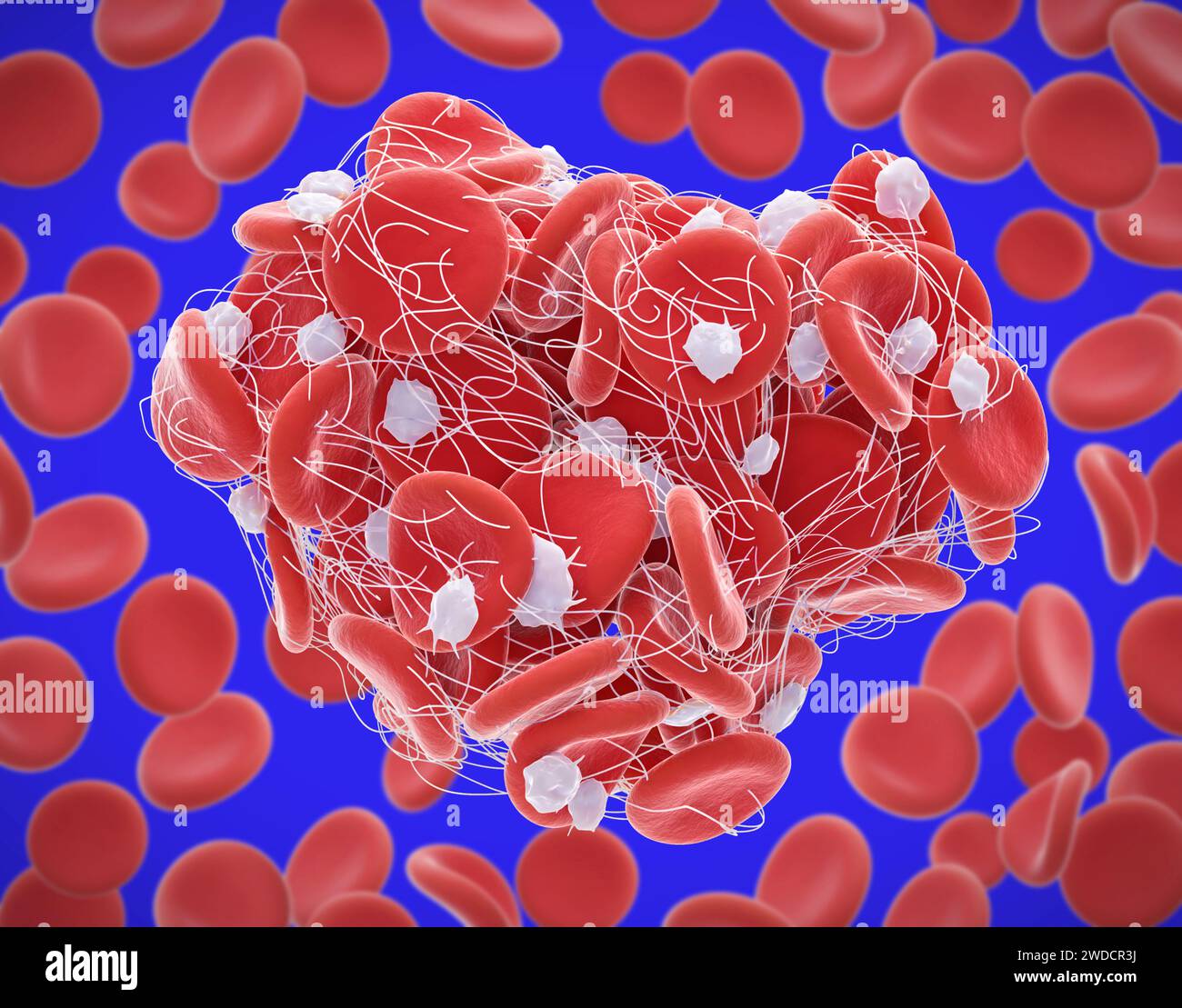 Blood Clot Illustration Stock Photo Alamy Blood Clot Illustration Stock Photo Alamy