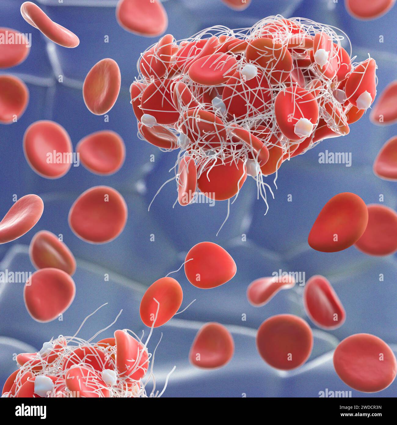 Illustration of red blood cells (erythrocytes) trapped in a fibrin mesh ...