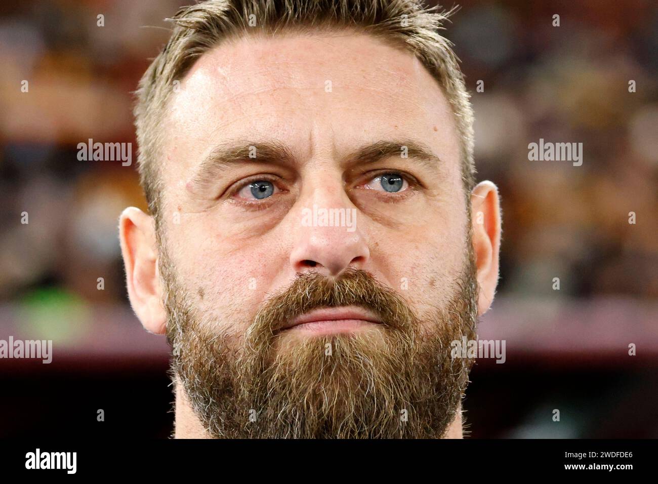 Colchicine in coronary artery and cerebrovascular disease: “Old skin for  the new ceremony”, image size:1300x956