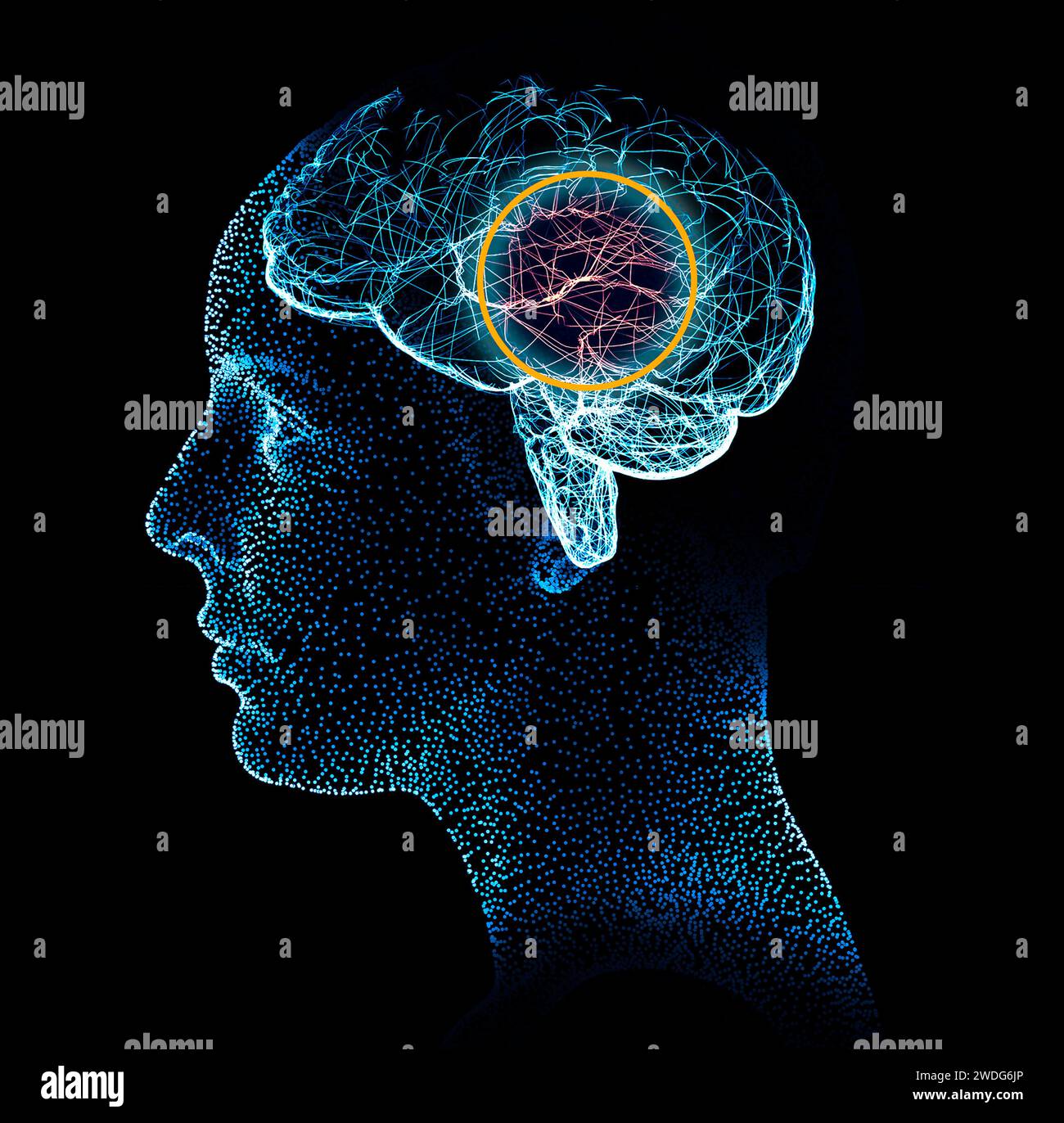 Memory lapses, forgetting things, degenerative disease. Brain problems. Parkinson and alzheimer desease. Mental health. Stroke, synapses and neurons Stock Photo