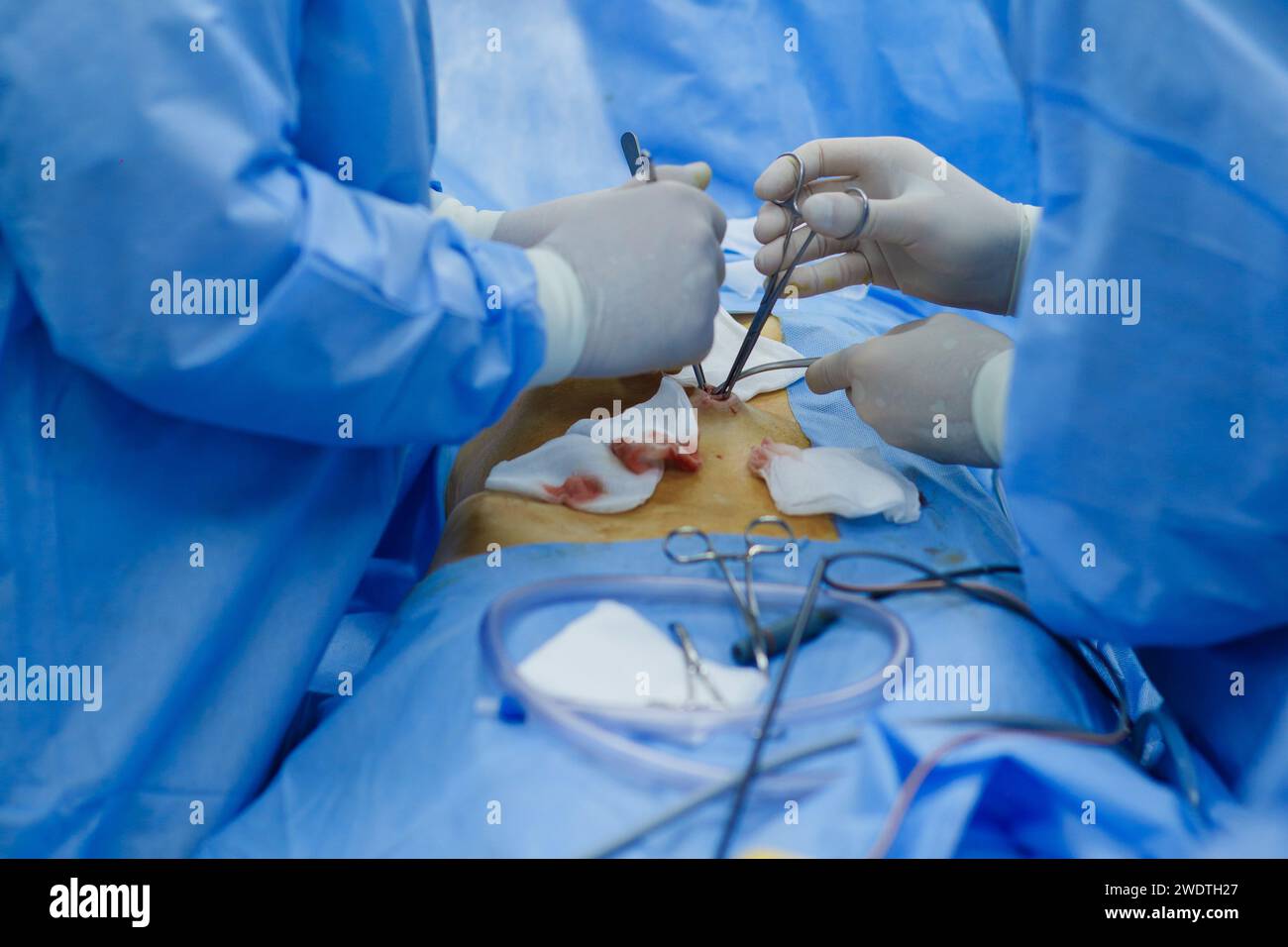 doctors perform laparoscopy operations in the intensive care unit. High quality photo Stock Photo