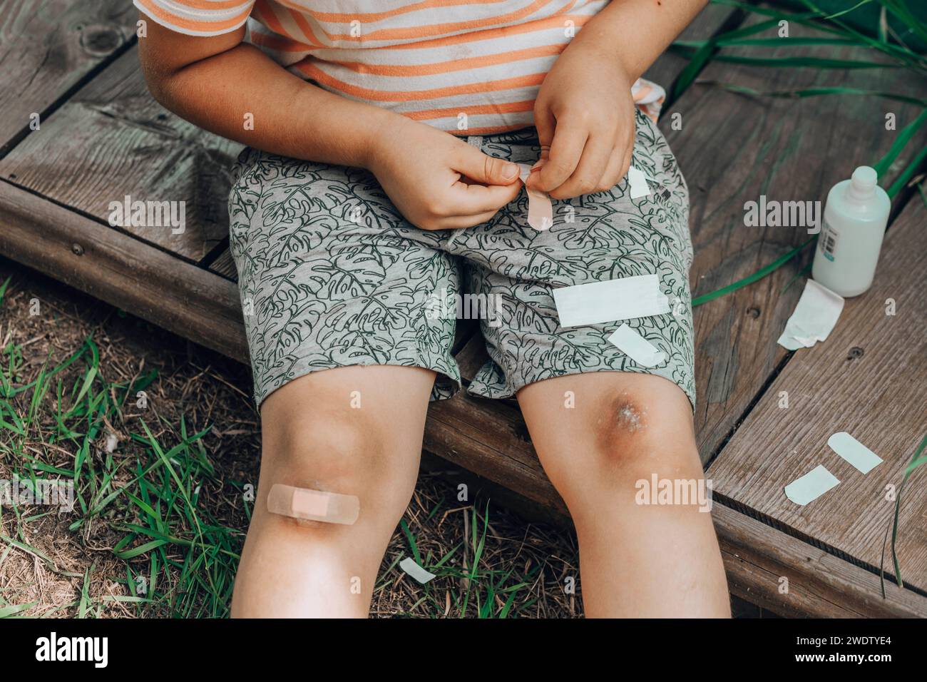 Road rash abrasion hires stock photography and images Alamy