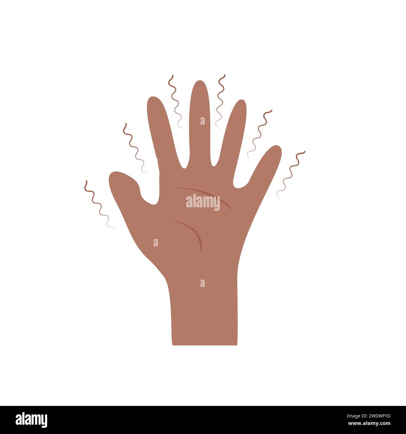 Black African American Hand with Tremor Syndrome. Parkinson disease. Trembling, Shivering arms. Physiological stress symptoms. Mental disorders, panic Stock Vector