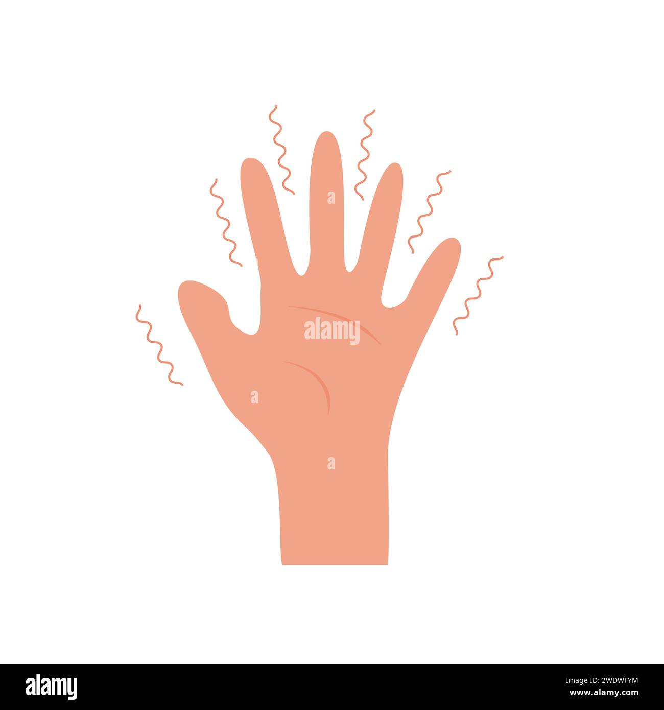 Hand with tremor symptom. Parkinson disease. Trembling or Shivering arms. Physiological stress symptoms. Mental disorders, panic, fear. Vector illustr Stock Vector