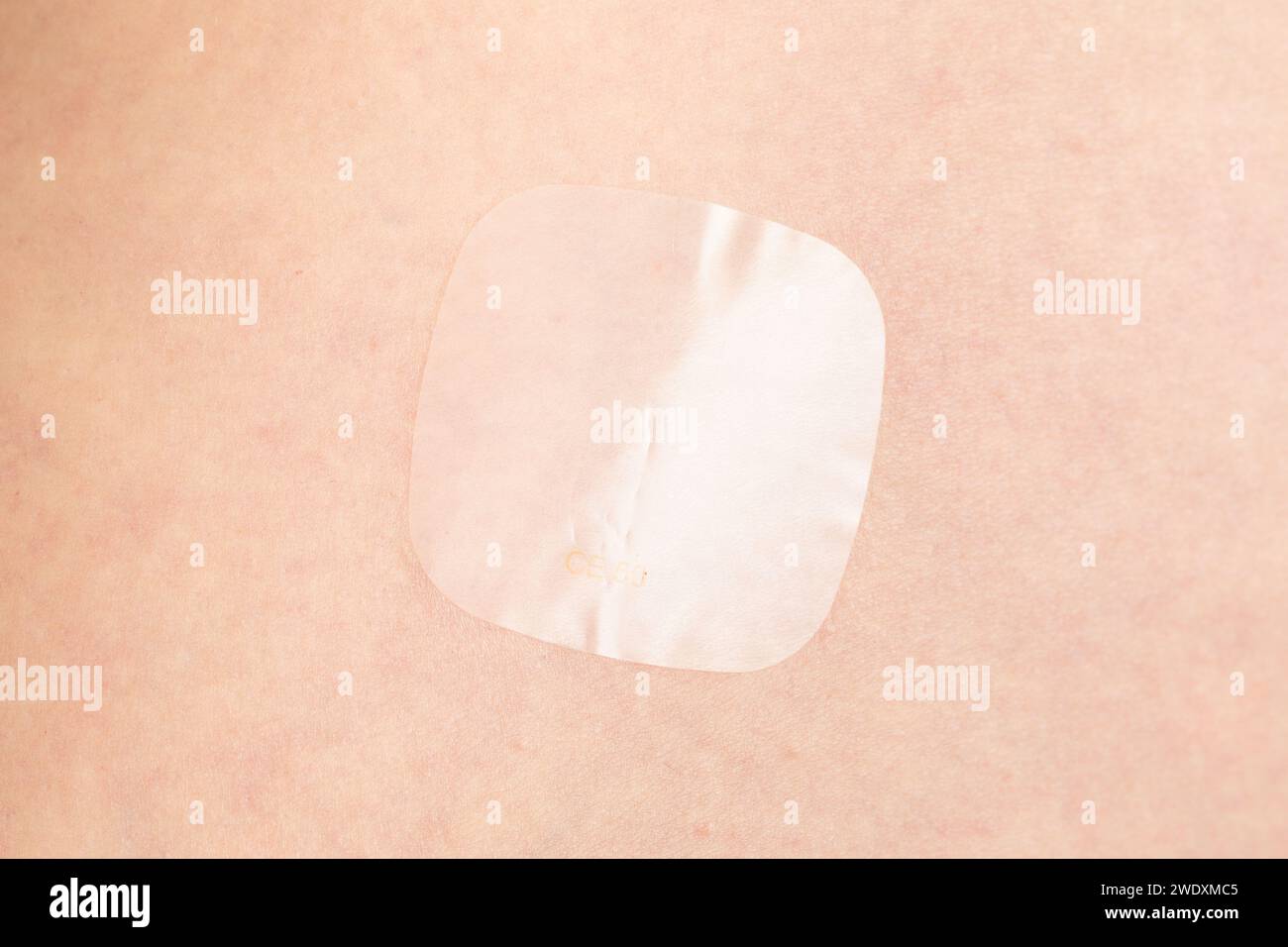 Hormone Replacement Therapy medication Evorel 50 (estradiol) patch on